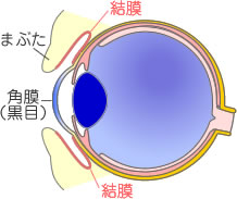 アレルギー性結膜炎イメージ画像1(結膜）