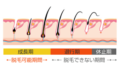 脱毛と毛周期の関係